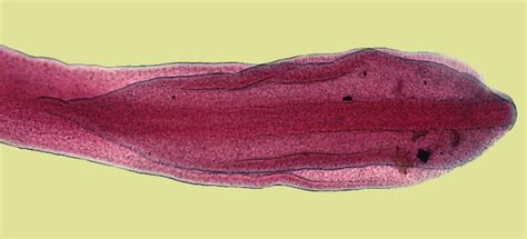 Cdc Dpdx Diphyllobothriasis