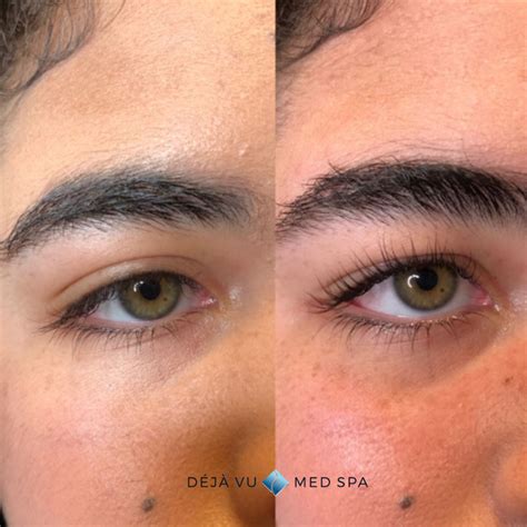 Lash Lift - Deja Vu Med Spa - Lash Lift Near Me Treatment