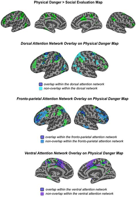 As Described Above These Regions Are Part Of The Default Mode Network Download Scientific