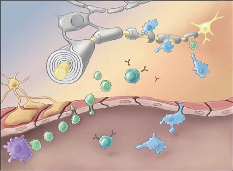 Pathophysiology Of Multiple Sclerosis