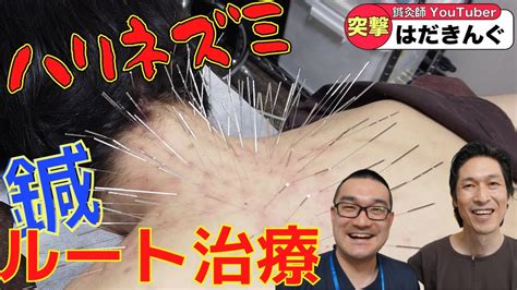 【閲覧注意】鍼灸ルート治療。何それ？鍼灸には様々な考え方がある。どこに行っても治らなかった慢性のコリも治る！？鍼灸ルート治療に力を入れ広げる