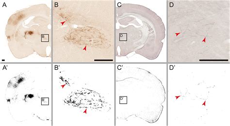 Frontiers Brain Wide Mapping Of Axonal Connections Workflow For