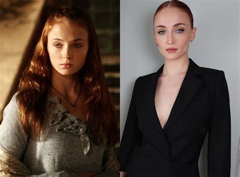 Sophie Turner S Alleged Buccal Fat Removal Before And After Pictures Of Sophie Turner That