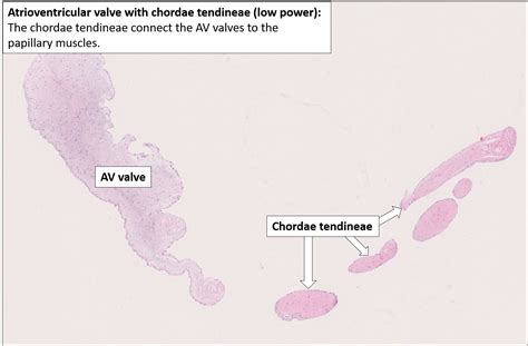 Atrioventricular Valve Histology