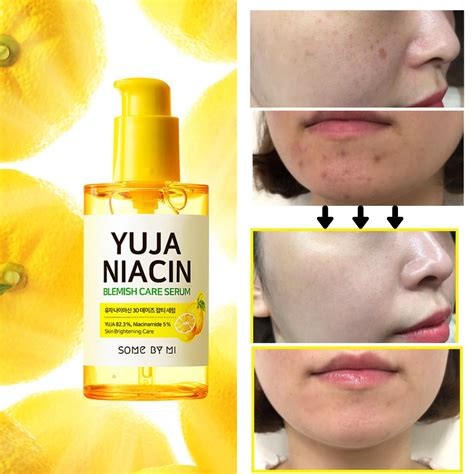 Some By Mi Yuja Niacin Blemish Care Serum 50ml Meihao