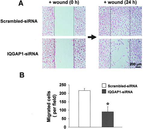 IQGAP1 A Novel Vascular Endothelial Growth Factor Receptor Binding