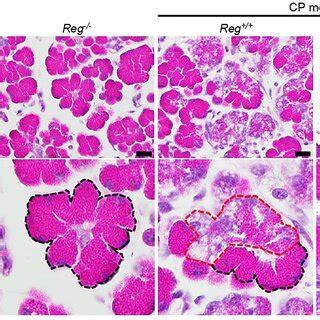 Representative H E Staining Of Pancreas Tissue Sections Of Indicated