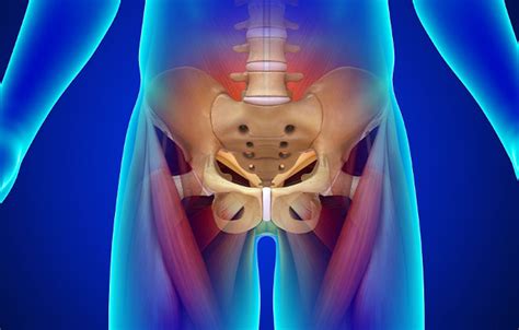 Piriformis Syndrome Capitola Get Piriformis Syndrome Relief