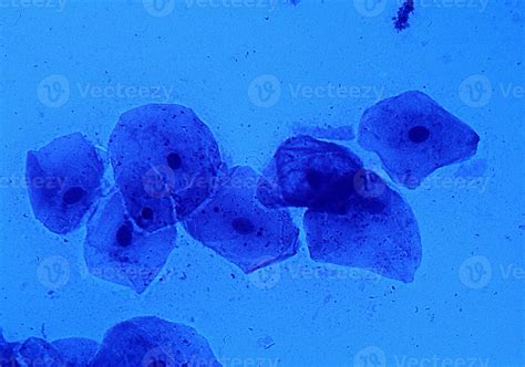 células epiteliales de la mucosa oral con núcleos celulares y bacterias