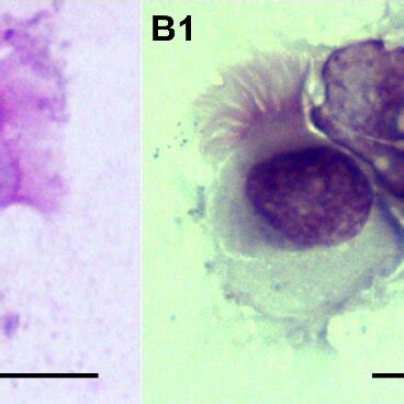 Comparison Of Morphology Between Bronchial Epithelial Ciliated Cells