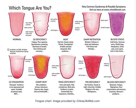 Tongue diagnosis in Chinese Medicine - The Wellness Studio and Pulse ...