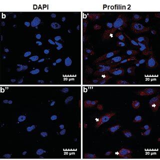 Profilin Expression On Hdac Transfection In Gc Cells Gc Cells