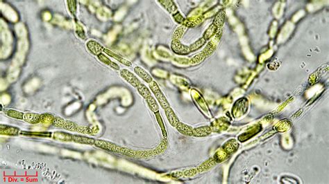 ./Cyanobacteria/Nostocales/Symphyonemataceae/Brachytrichia/sp ...