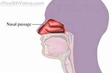 Nosebleed Definition, Causes, Symptoms, Complications and Cost Surgery ...