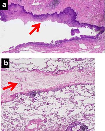 Histopathological Findings Hematoxylin And Eosin Stain A A