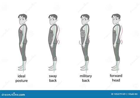 Types of Posture in Men. Vector Illustration Stock Vector ...