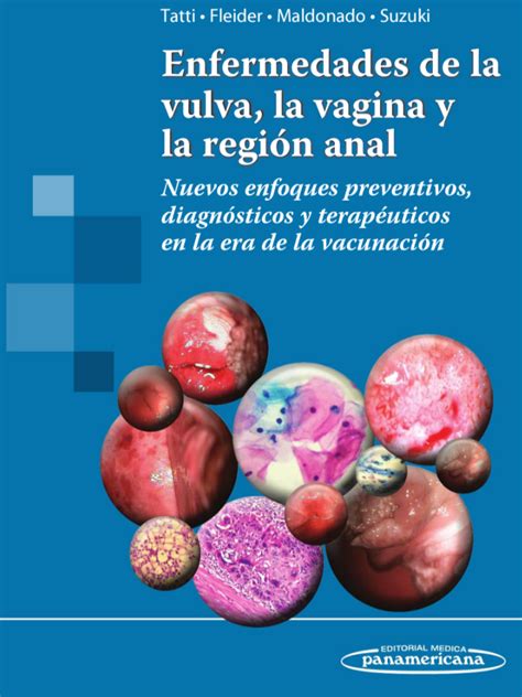 Enfermedades de la vulva la vagina y la región anal Tatti Fleider Maldonado Suzuki MEDIX