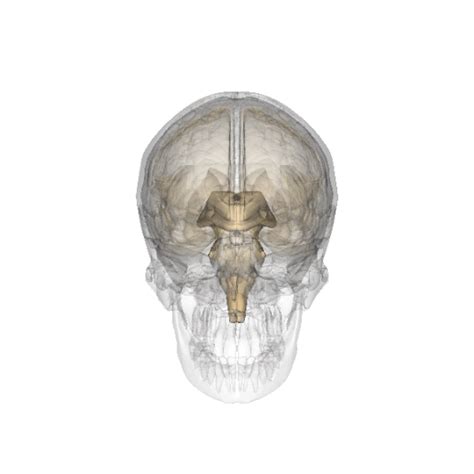 Pineal cyst development and treatment - full information