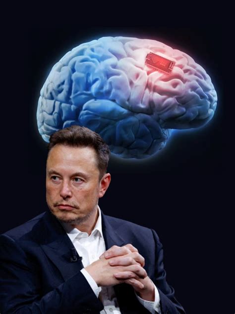 ¿para Qué Sirve El Chip Cerebral Creado Por La Empresa De Elon Musk Infobae Stories