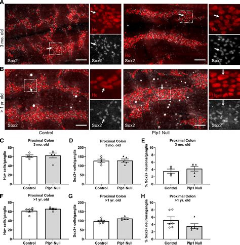 Proteolipid Protein Is Involved In The Regulation Of Intestinal