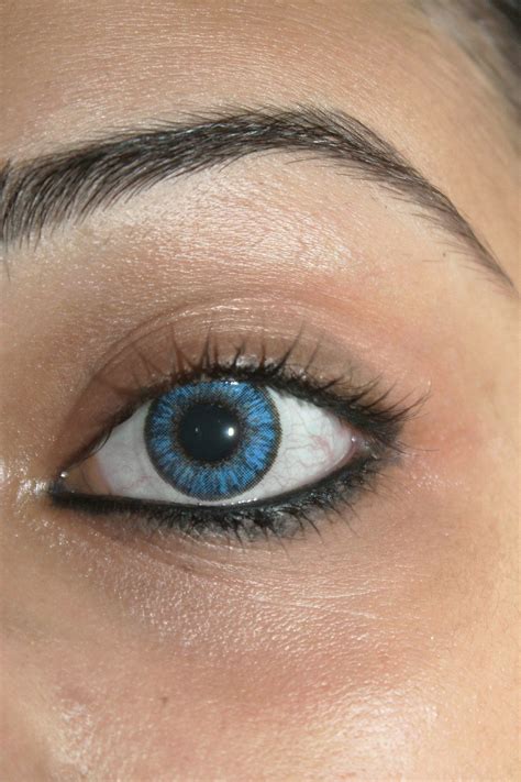 Outbreak Of Preventable Eye Infection In Contact Lens Wearers