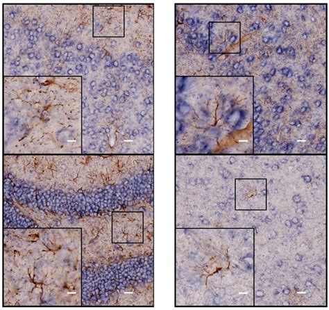 Adam10 In Situ Hybridizationpositive Cells Are GFAPnegative In