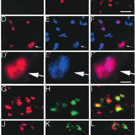 Regulation Of Neuronal Apoptosis By The Spinal GT And NMDAR Activity