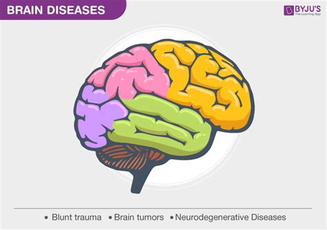 Brain Diseases - Types, Causes, Symptoms, and its Treatment