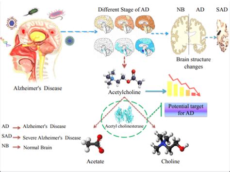 Overview Of Alzheimer S Disease AD Acetylcholinesterase AChE Is