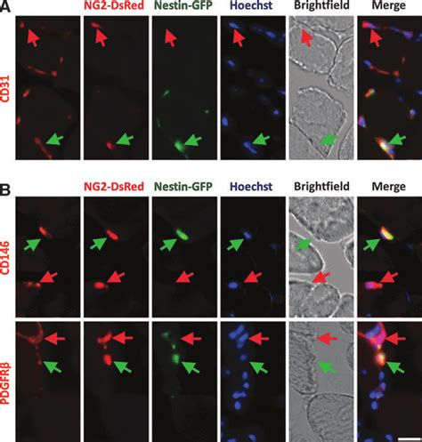 Two Bona Fide Pericyte Subtypes In Skeletal Muscle Histological