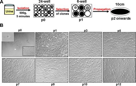 Multipotential Differentiation Of Human Urinederived Stem Cells