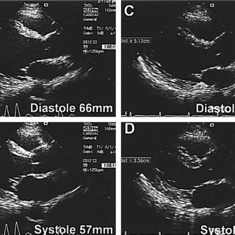 The Two Dimensional Echocardiograms Taken Before A B And Months