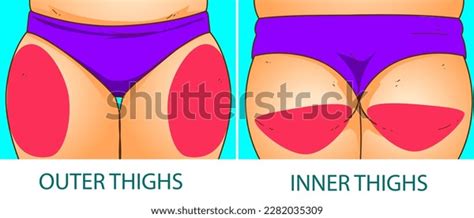 Womans Body Problem Areas Medical Infographic Stock Vector (Royalty ...