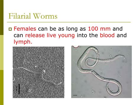 Ppt Chapter 15 Phylum Nematoda The Roundworms Powerpoint