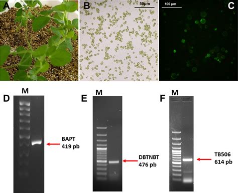 Frontiers A Novel Hydroxylation Step In The Taxane Biosynthetic