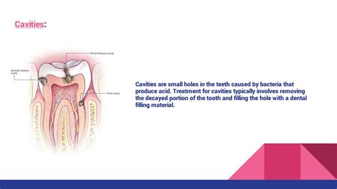 Ppt Common Dental Problems And Their Treatments Powerpoint