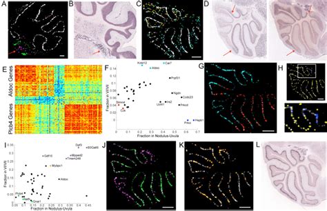 Identification Of Novel Variation In Cerebellar Gene Expression By