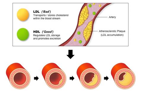 Ib Hl 23a3 Lipids And Long Term Storage