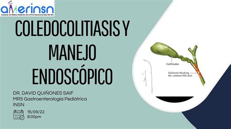 COLEDOCOLITIASIS Y MANEJO ENDOSCÓPICO Dr David Quiñones Saif YouTube