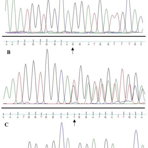 Neutrophil Functional Assay Nitroblue Tetrazolium Nbt Slide Tests