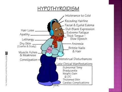 Endocrinology thyroid disorder