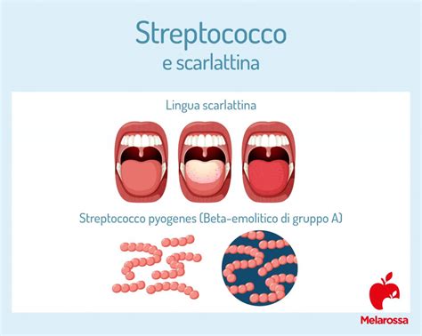 Streptococco Cos Tipi Diagnosi Complicazioni E Cura