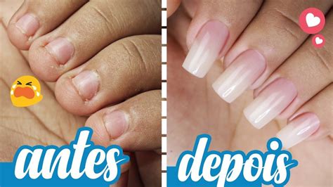 Transforma O De Unhas Curtas E Ro Das Antes E Depois Youtube