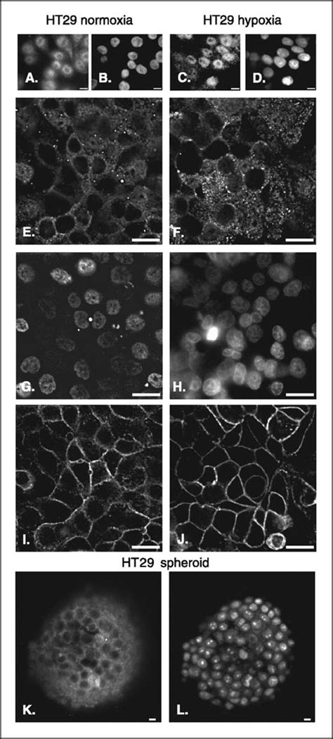 Expression And Nuclear Location Of The Transcriptional Repressor Kaiso