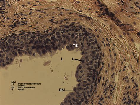 Transitional Epithelium Labeled Basement Membrane