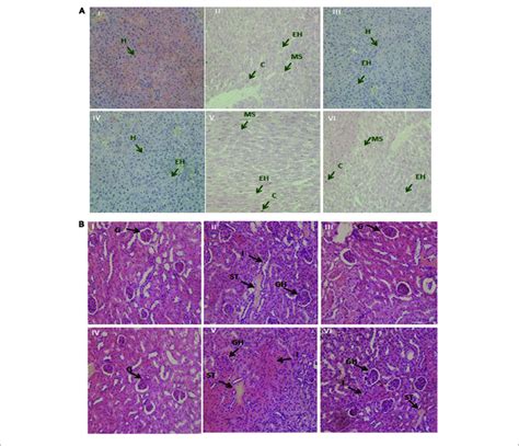 A The Demonstrative Micrographs Of The Hepatic Liver Tissues Of Download Scientific