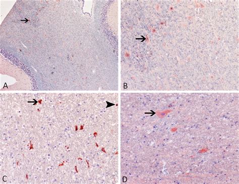 Immunohistochemical Analysis Of The Cerebellum And Cerebral Cortex Of