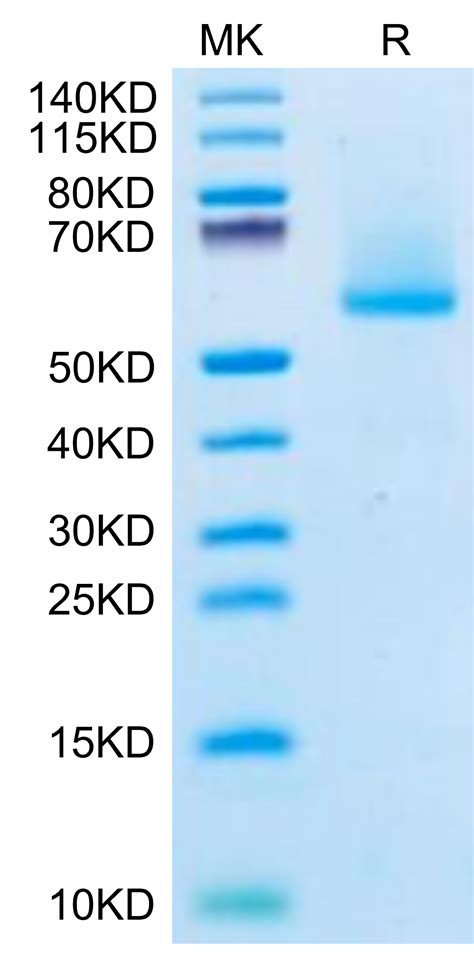 Biotinylated Human Fgf21 Protein Recombinant Reprokine