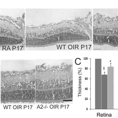 A H And E Staining Of Retinal Sections From Wt Ra Wt Oir And A2−− Oir