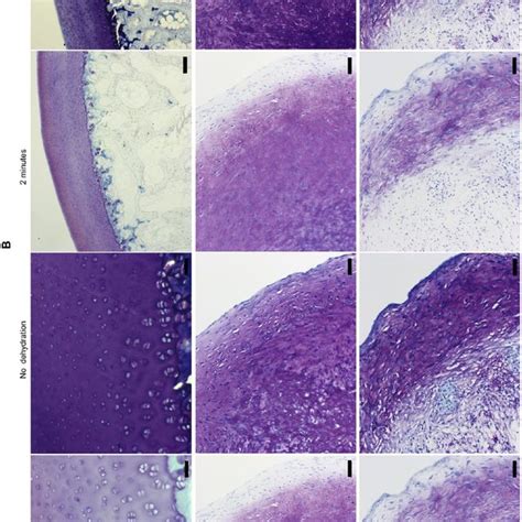 Representative Images Showing Toluidine Blue Staining Of Sections Of